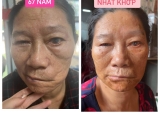 TRỊ ĐAU NHỨC XƯƠNG KHỚP TPHCM