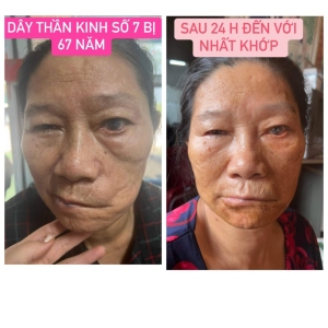 TRỊ ĐAU NHỨC XƯƠNG KHỚP TPHCM