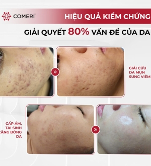COMERI DẪN ĐẦU XU HƯỚNG LÀM ĐẸP 2025